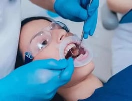 Root Canal treatment